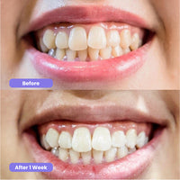 Standard Whitening Duo