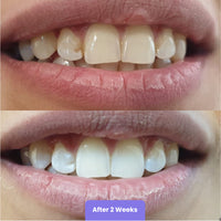 Pro Whitening Duo