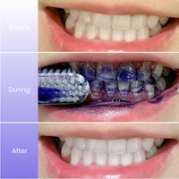 Ultimate Whitening Bundle